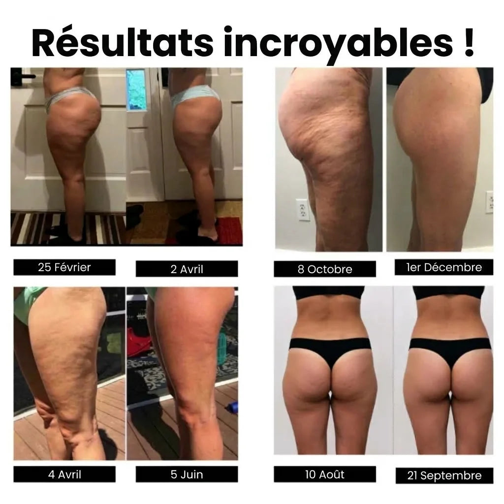 SpringFit™ Legging anti-cellulite