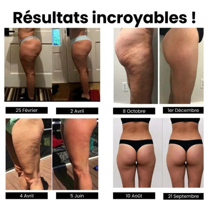 SpringFit™ Legging anti-cellulite